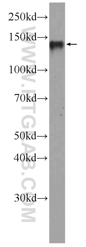 Western Blot (WB) analysis of HepG2 cells using RTEL1 Polyclonal antibody (25337-1-AP)