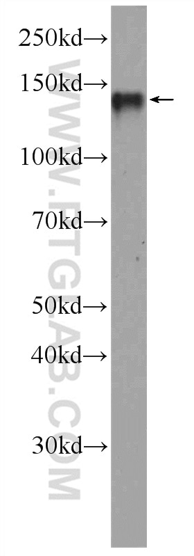 Western Blot (WB) analysis of HepG2 cells using RTEL1 Polyclonal antibody (25337-1-AP)