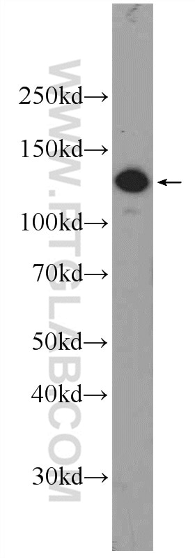 Western Blot (WB) analysis of BGC-823 cells using RTEL1 Polyclonal antibody (25337-1-AP)