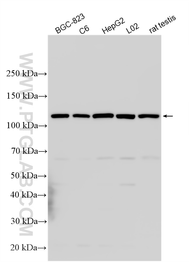 Western Blot (WB) analysis of various lysates using RTEL1 Polyclonal antibody (25337-1-AP)