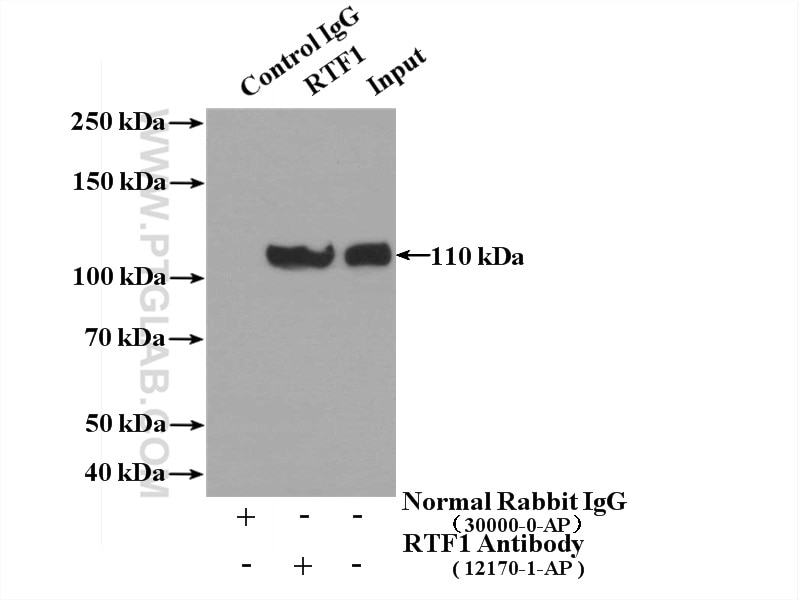 Immunoprecipitation (IP) experiment of HeLa cells using RTF1 Polyclonal antibody (12170-1-AP)