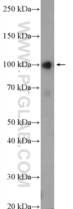 Western Blot (WB) analysis of HL-60 cells using RTF1 Polyclonal antibody (12170-1-AP)