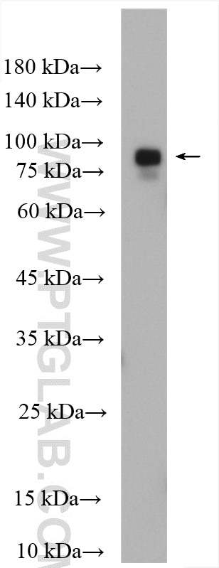 Western Blot (WB) analysis of rat brain tissue using RTF1 Polyclonal antibody (12170-1-AP)