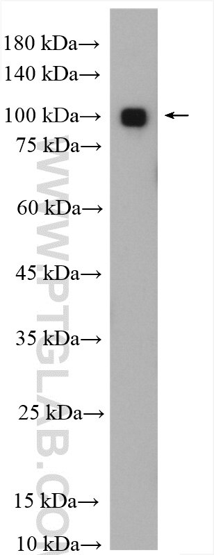 Western Blot (WB) analysis of mouse brain tissue using RTF1 Polyclonal antibody (12170-1-AP)