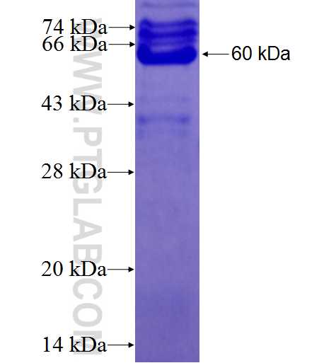 RTF1 fusion protein Ag2812 SDS-PAGE