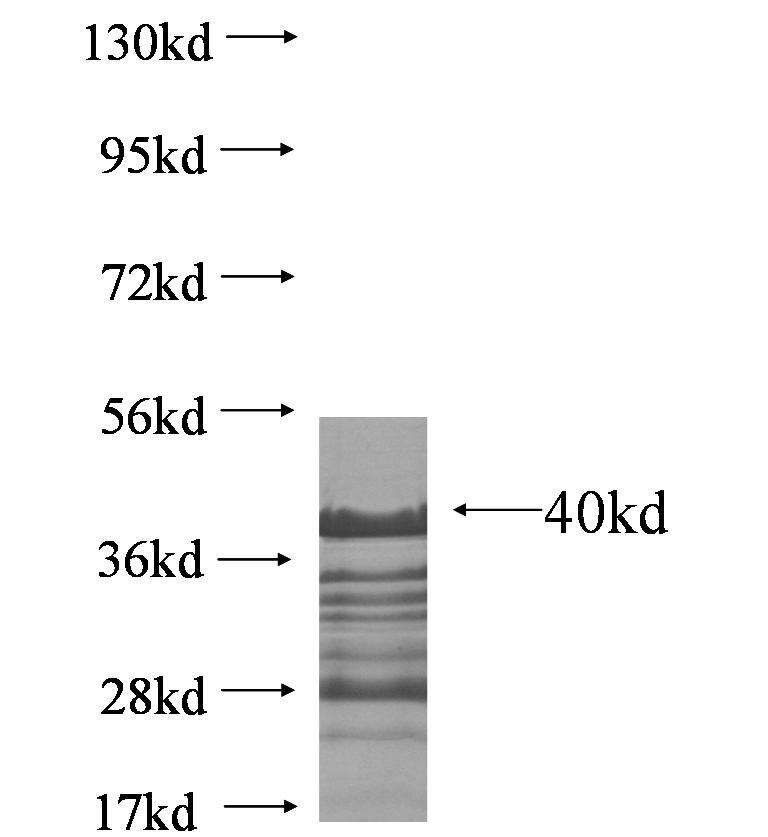 RTF1 fusion protein Ag8285 SDS-PAGE RTF1 fusion protein Ag8285 SDS-PAGE