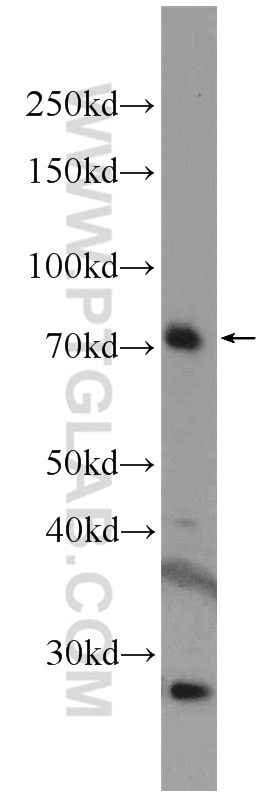 Western Blot (WB) analysis of mouse brain tissue using RTKN Polyclonal antibody (12762-1-AP)