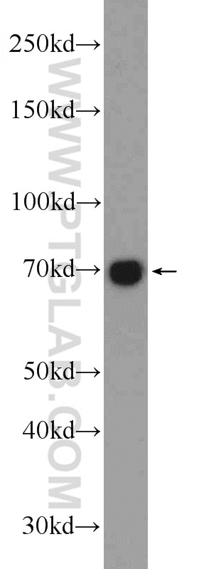 Western Blot (WB) analysis of rat brain tissue using RTKN Polyclonal antibody (12762-1-AP)