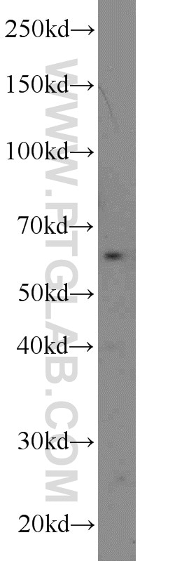 Western Blot (WB) analysis of A431 cells using RTKN Polyclonal antibody (12762-1-AP)