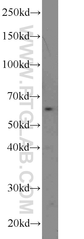 WB analysis of A431 using 12762-1-AP