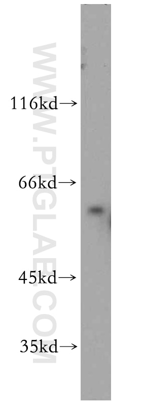 Western Blot (WB) analysis of A431 cells using RTKN Polyclonal antibody (12762-1-AP)