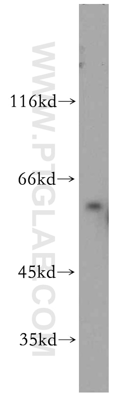 WB analysis of A431 using 12762-1-AP