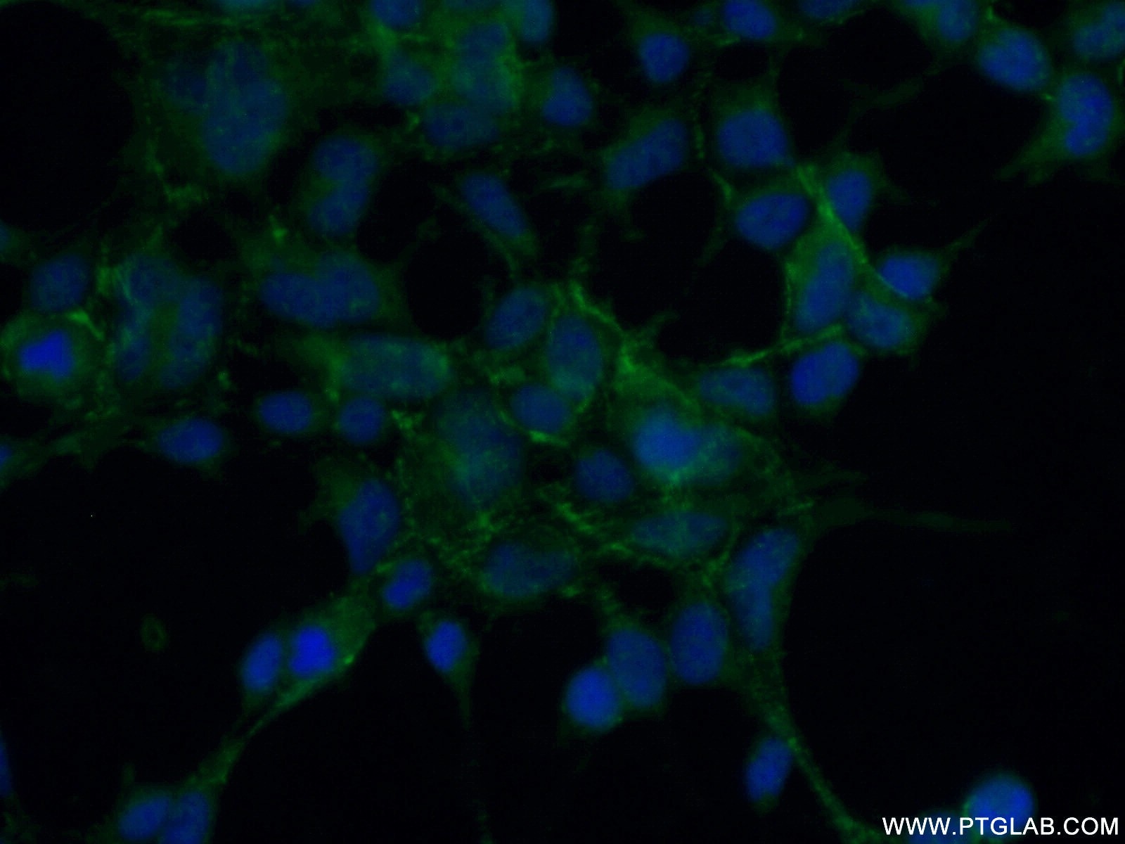Immunofluorescence (IF) / fluorescent staining of HEK-293 cells using RTKN2 Polyclonal antibody (17458-1-AP)