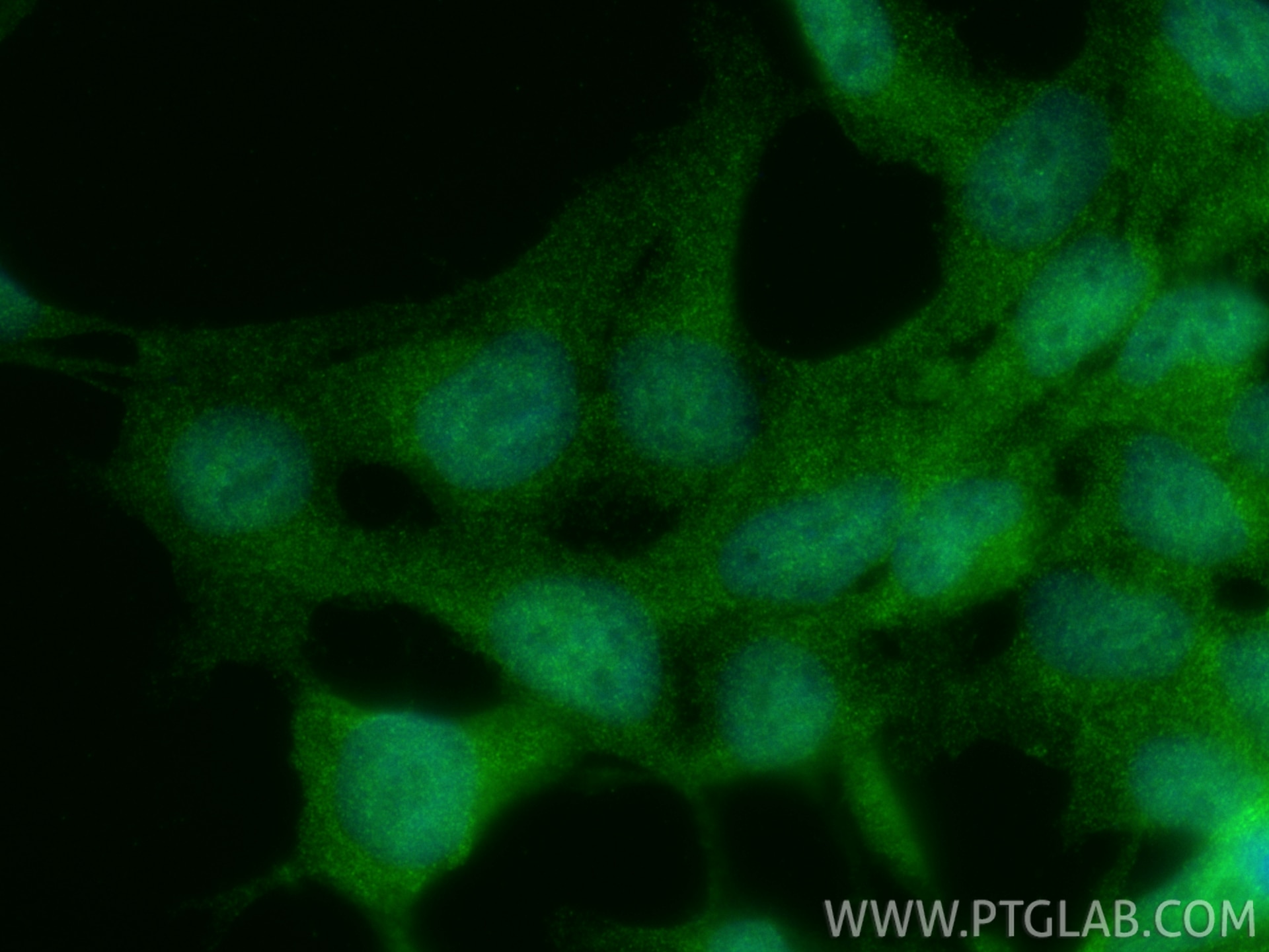 Immunofluorescence (IF) / fluorescent staining of HEK-293 cells using RTKN2 Polyclonal antibody (17458-1-AP)