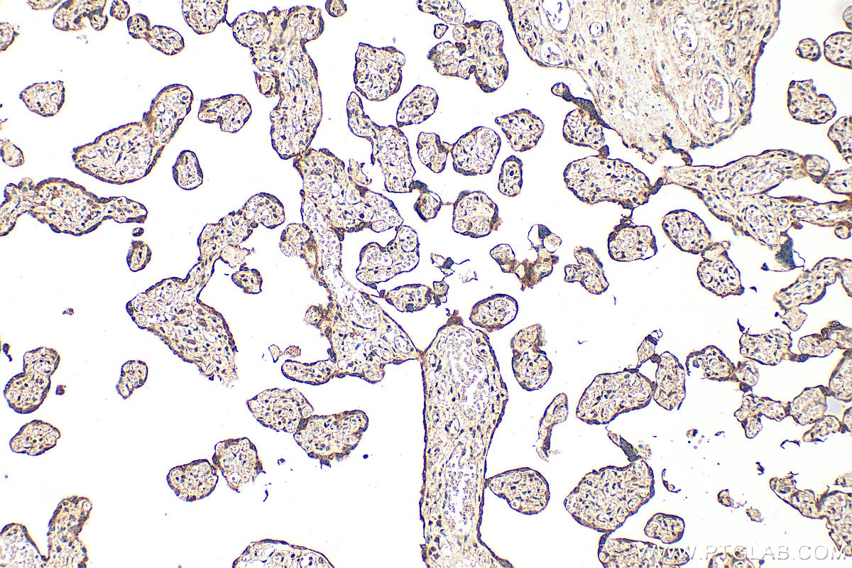Immunohistochemistry (IHC) staining of human placenta tissue using RTKN2 Polyclonal antibody (17458-1-AP)