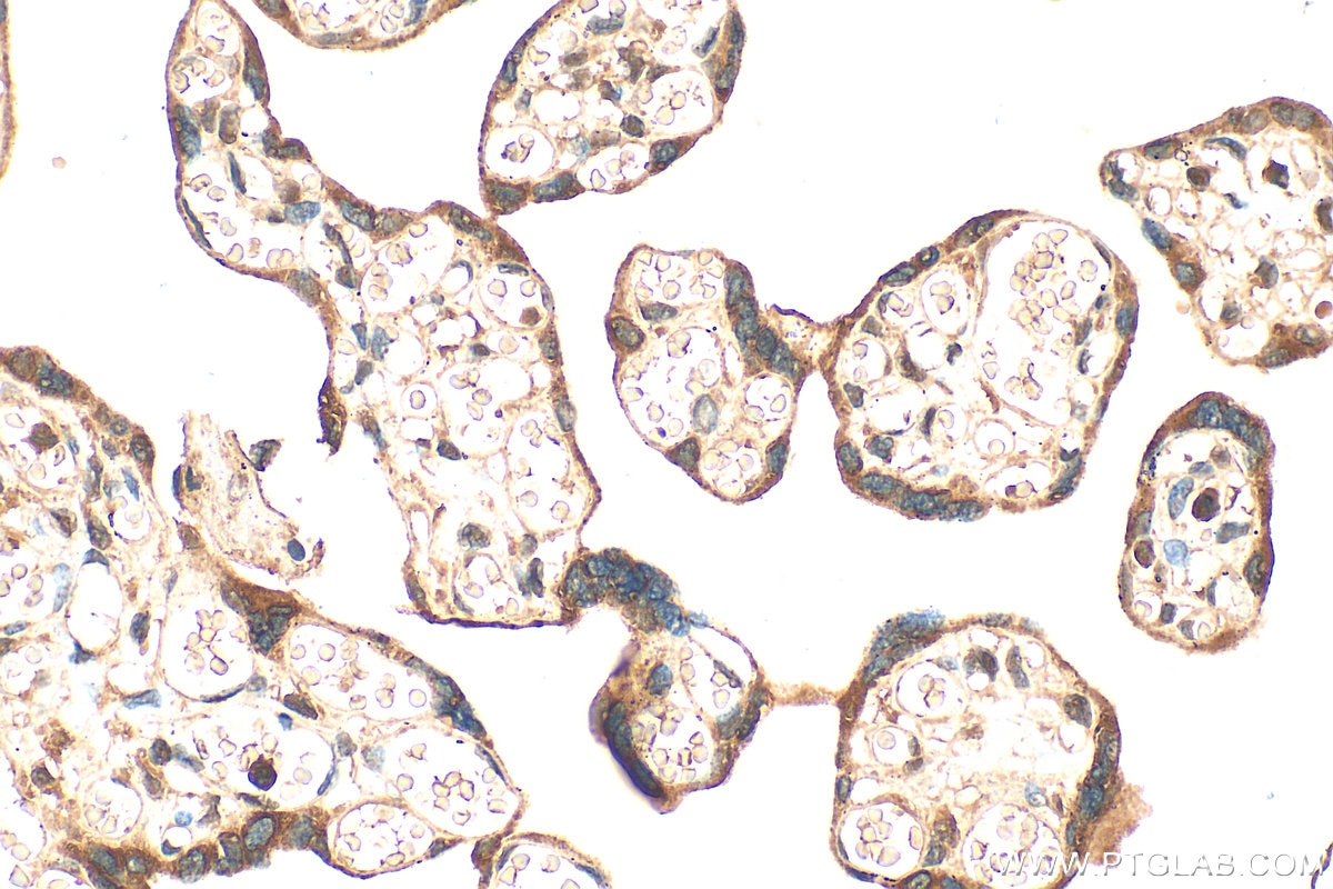 Immunohistochemistry (IHC) staining of human placenta tissue using RTKN2 Polyclonal antibody (17458-1-AP)