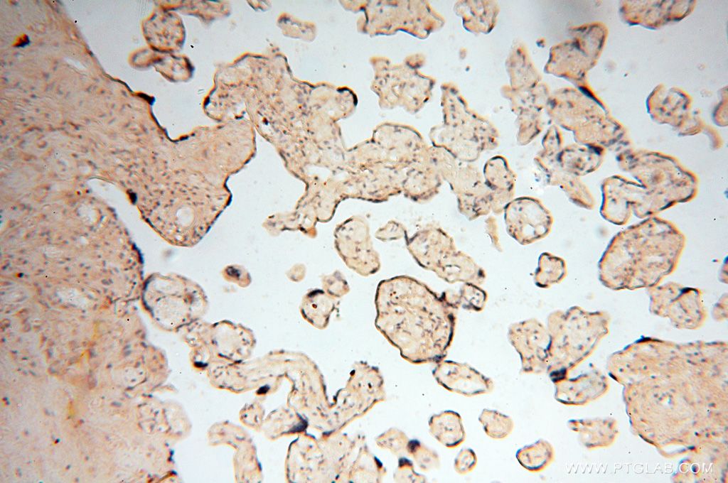 IHC staining of human placenta using 17458-1-AP