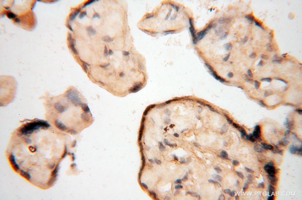 IHC staining of human placenta using 17458-1-AP