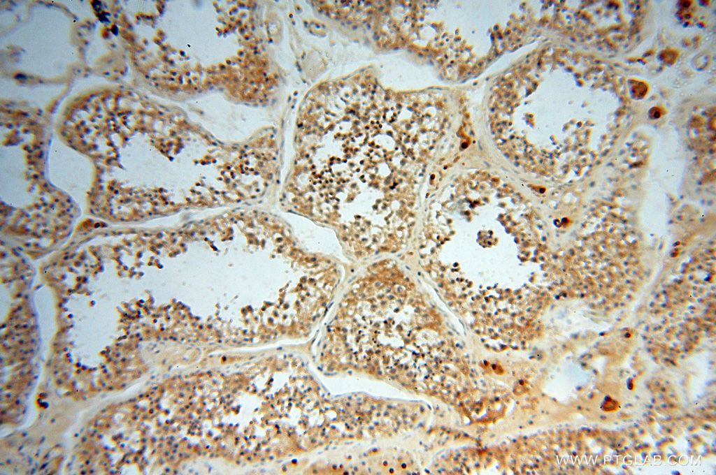 Immunohistochemistry (IHC) staining of human testis tissue using RTKN2 Polyclonal antibody (17458-1-AP)