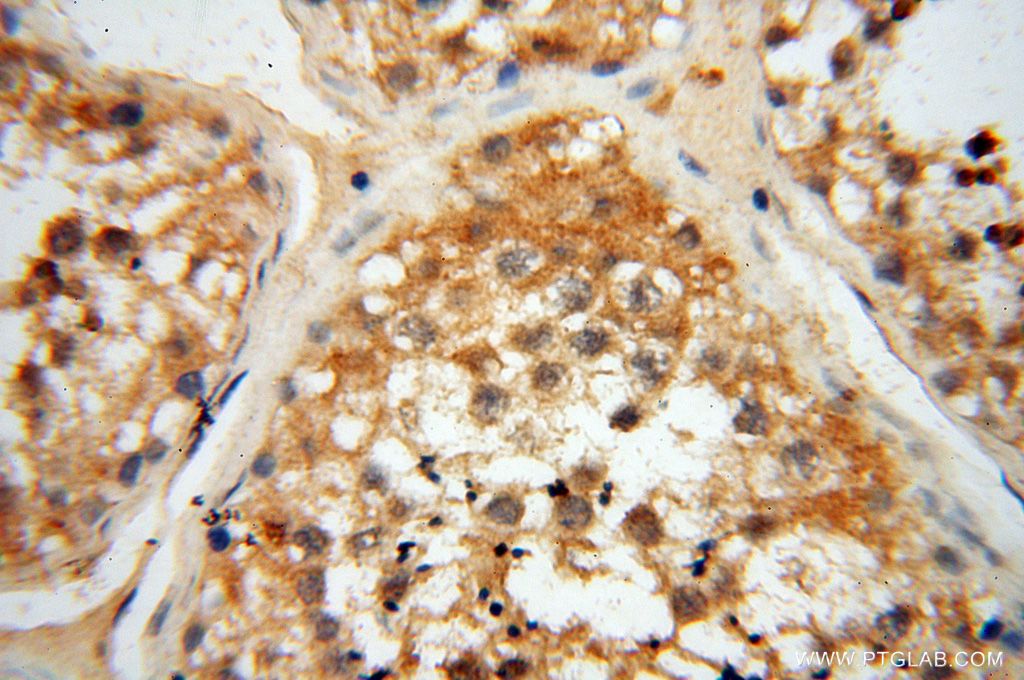 Immunohistochemistry (IHC) staining of human testis tissue using RTKN2 Polyclonal antibody (17458-1-AP)