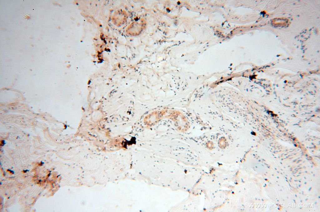 Immunohistochemistry (IHC) staining of human skin tissue using RTKN2 Polyclonal antibody (17458-1-AP)