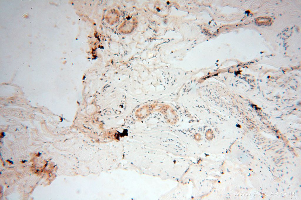 IHC staining of human skin using 17458-1-AP