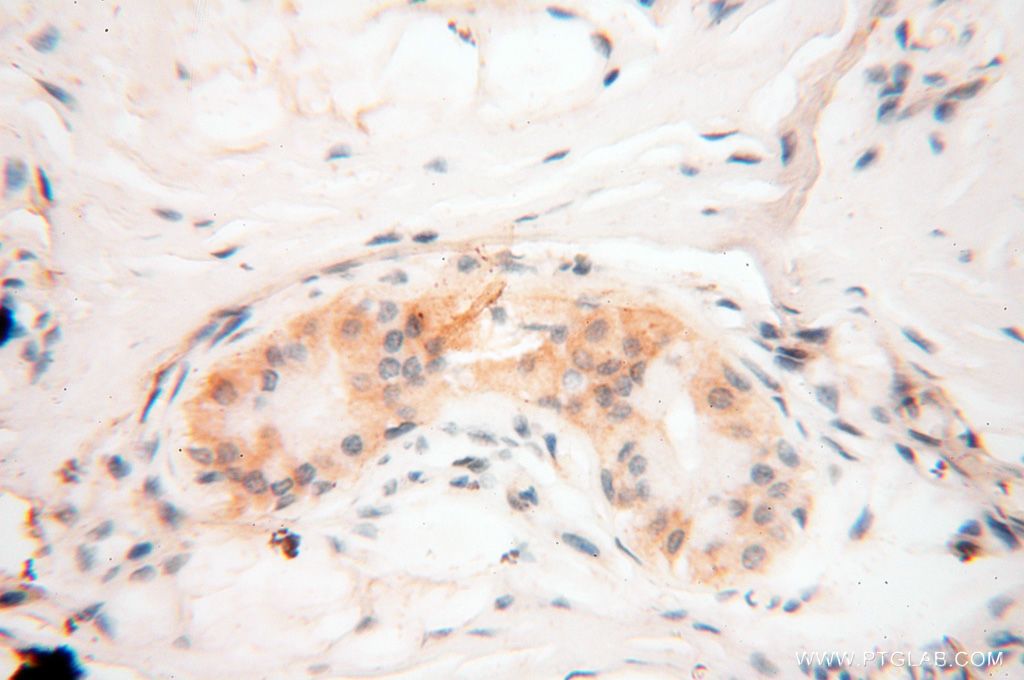 Immunohistochemistry (IHC) staining of human skin tissue using RTKN2 Polyclonal antibody (17458-1-AP)