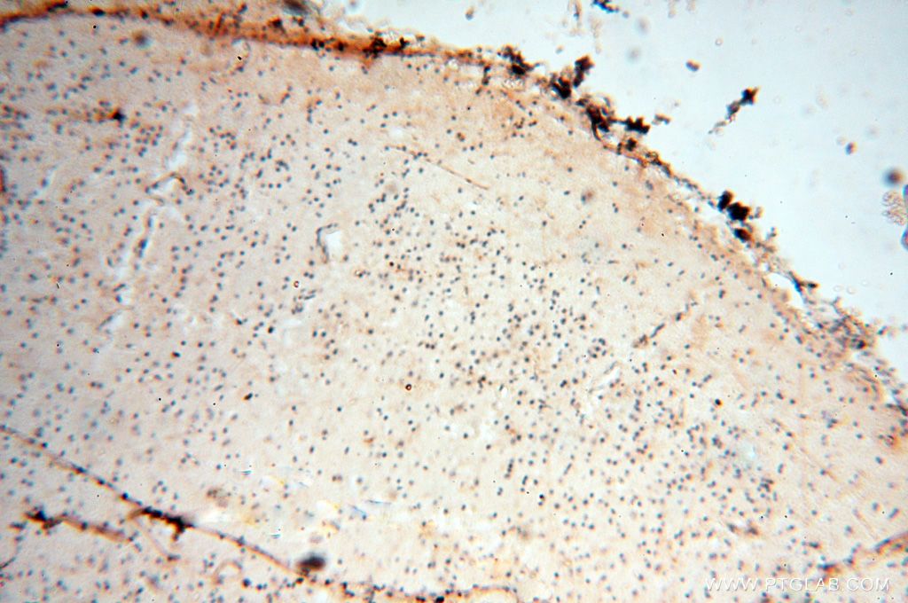 Immunohistochemistry (IHC) staining of human brain tissue using RTKN2 Polyclonal antibody (17458-1-AP)