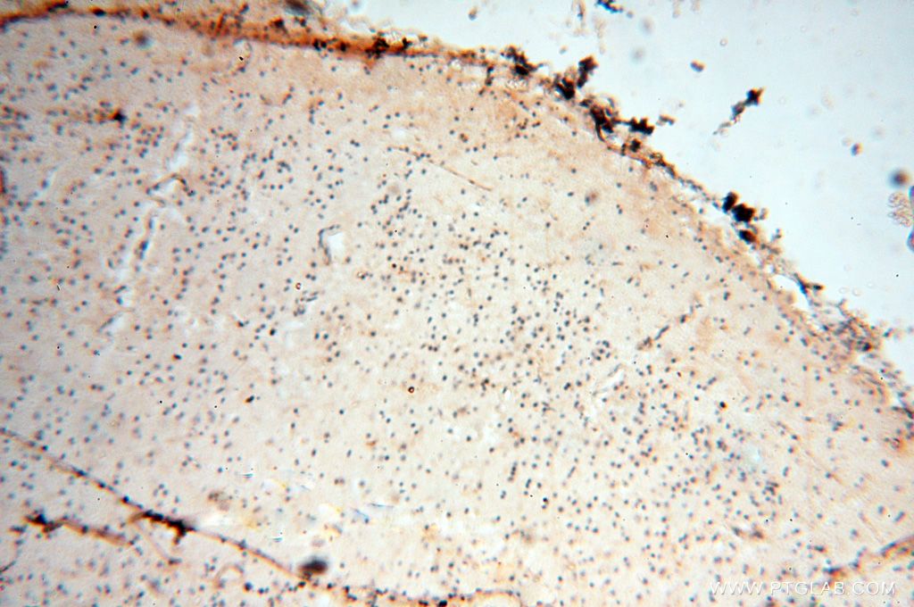 IHC staining of human brain using 17458-1-AP