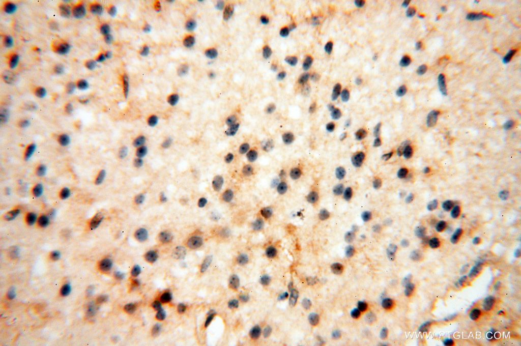 Immunohistochemistry (IHC) staining of human brain tissue using RTKN2 Polyclonal antibody (17458-1-AP)