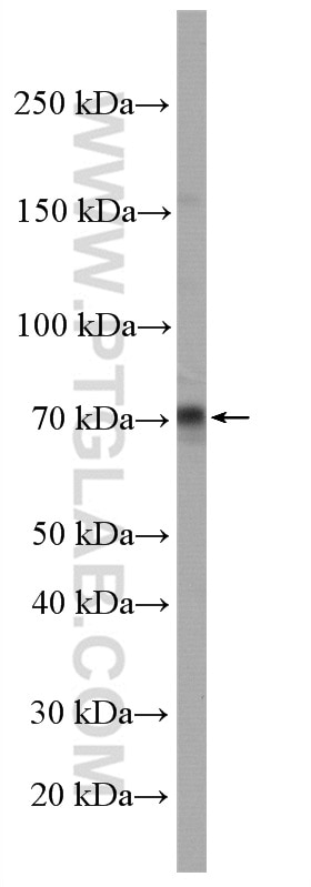 Western Blot (WB) analysis of Raji cells using RTKN2 Polyclonal antibody (17458-1-AP)