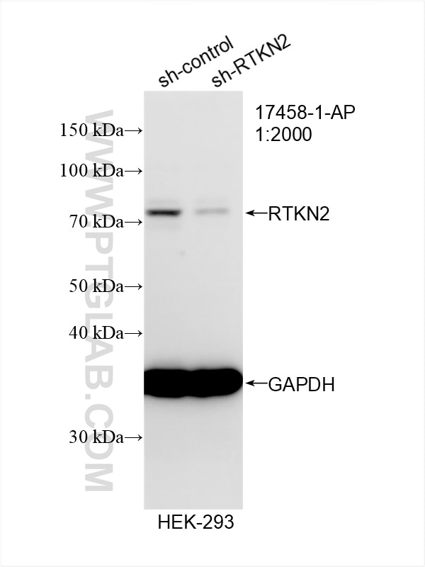 Western Blot (WB) analysis of HEK-293 cells using RTKN2 Polyclonal antibody (17458-1-AP)
