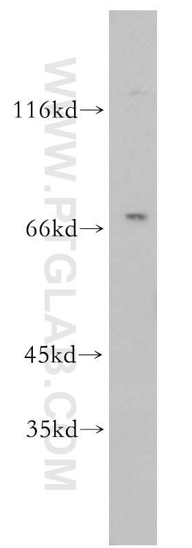 Western Blot (WB) analysis of HL-60 cells using RTKN2 Polyclonal antibody (17458-1-AP)