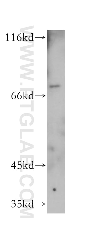 Western Blot (WB) analysis of mouse lymph tissue using RTKN2 Polyclonal antibody (17458-1-AP)
