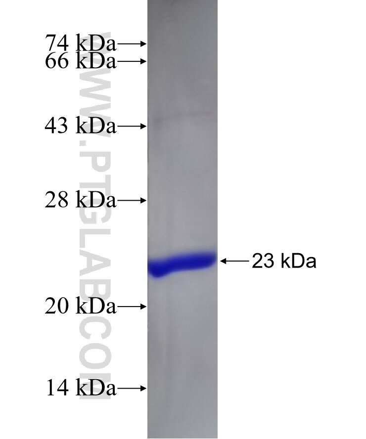 RTKN2 fusion protein Ag11098 SDS-PAGE