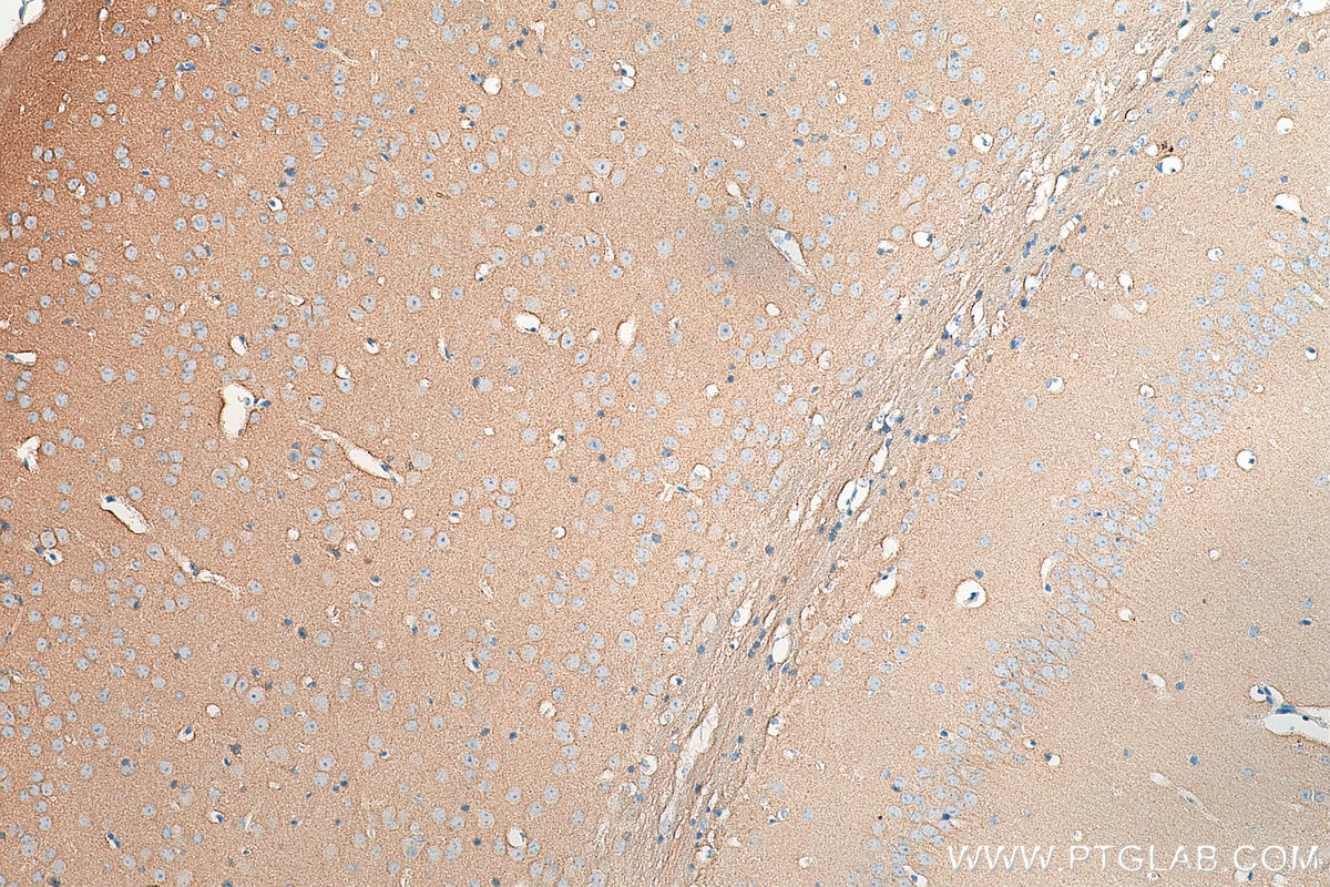 IHC staining of mouse brain using 15048-1-AP