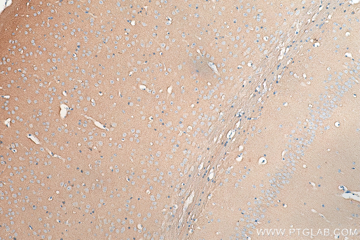 Immunohistochemistry (IHC) staining of mouse brain tissue using RTN1 (Isoform RTN1-C) Polyclonal antibody (15048-1-AP)