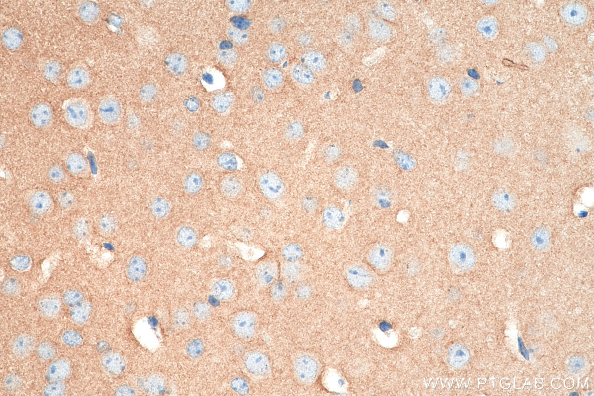 Immunohistochemistry (IHC) staining of mouse brain tissue using RTN1 (Isoform RTN1-C) Polyclonal antibody (15048-1-AP)