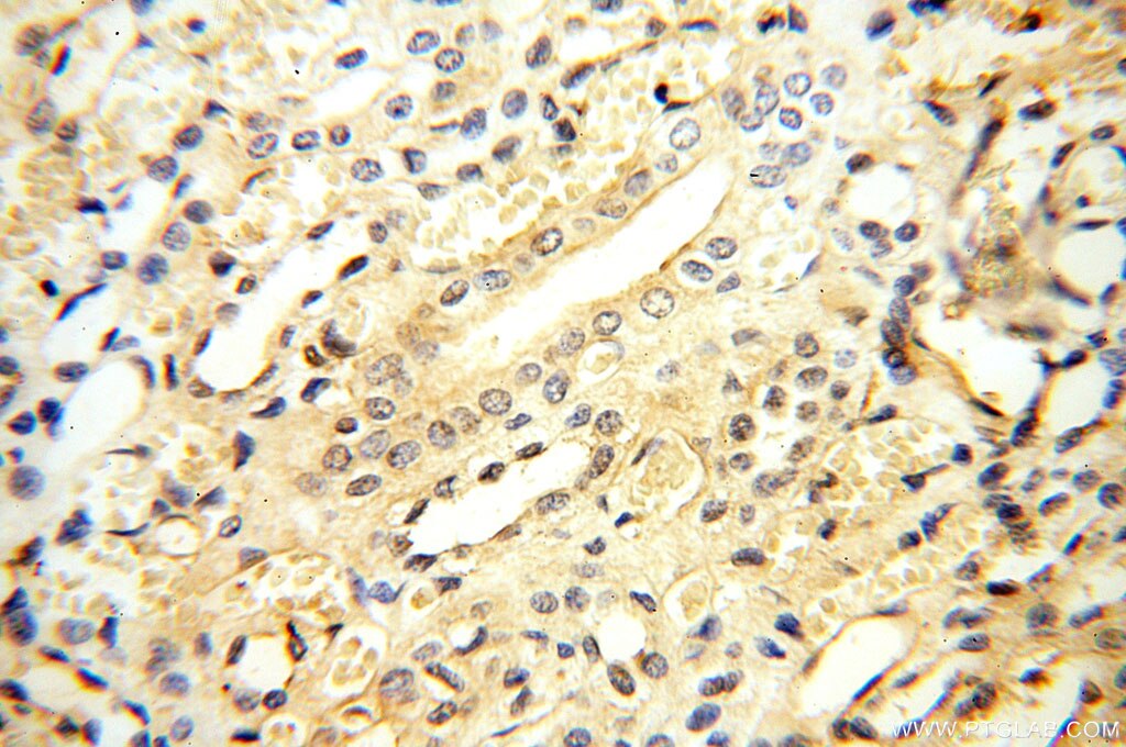 RTN1 (Isoform RTN1-C)