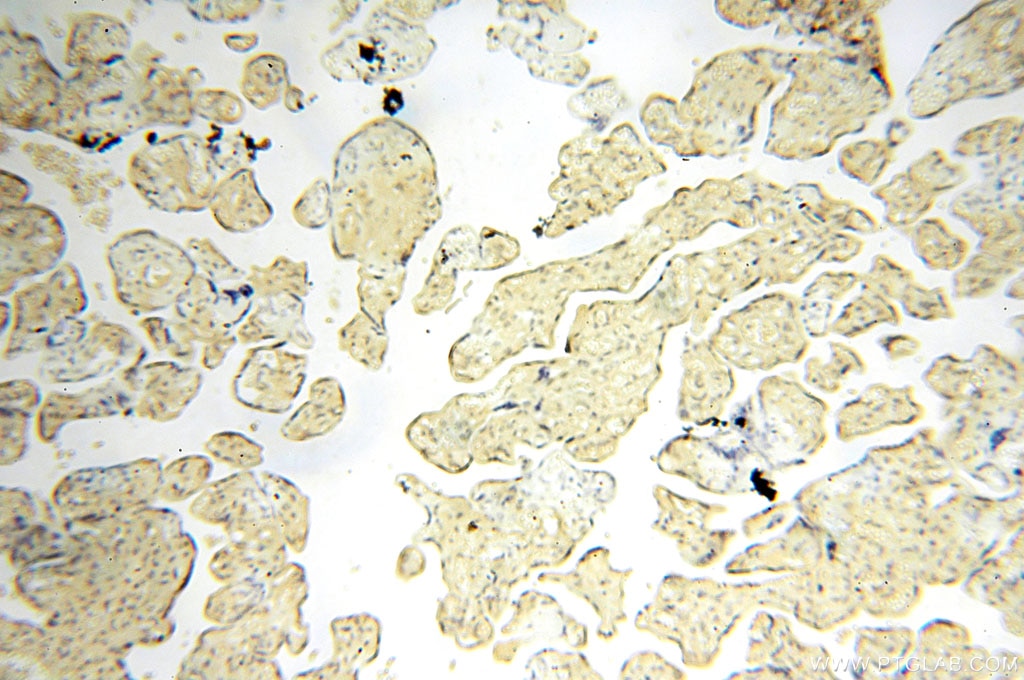 Immunohistochemistry (IHC) staining of human placenta tissue using RTN1 (Isoform RTN1-C) Polyclonal antibody (15048-1-AP)
