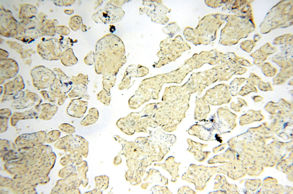 IHC staining of human placenta using 15048-1-AP