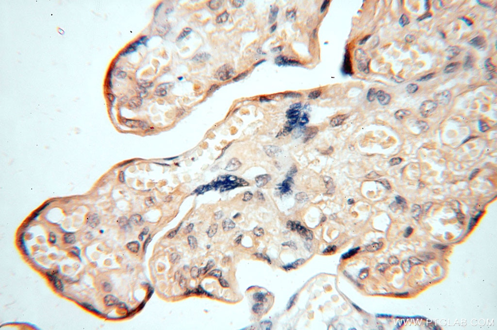 IHC staining of human placenta using 15048-1-AP