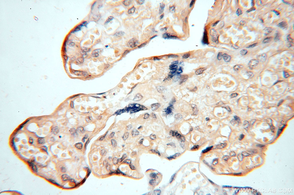 Immunohistochemistry (IHC) staining of human placenta tissue using RTN1 (Isoform RTN1-C) Polyclonal antibody (15048-1-AP)