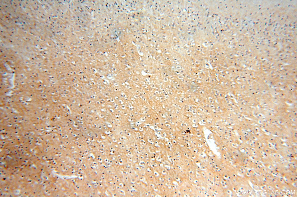 Immunohistochemistry (IHC) staining of human brain tissue using RTN1 (Isoform RTN1-C) Polyclonal antibody (15048-1-AP)