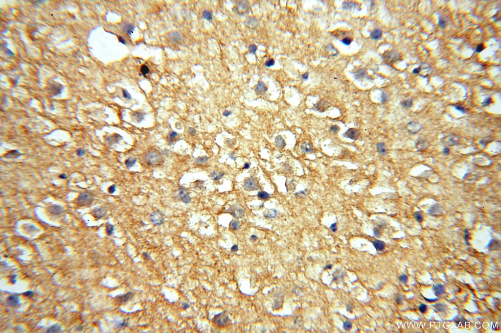 Immunohistochemistry (IHC) staining of human brain tissue using RTN1 (Isoform RTN1-C) Polyclonal antibody (15048-1-AP)