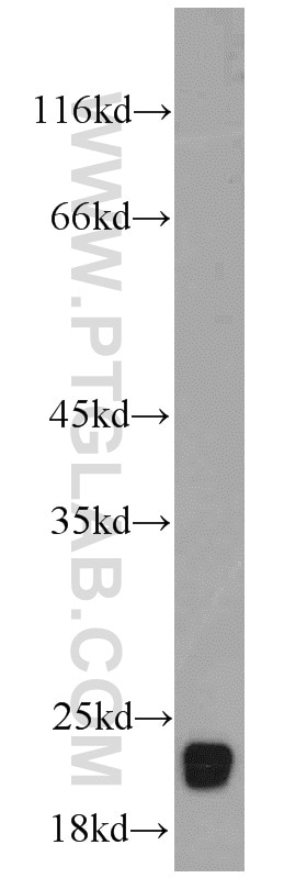 Western Blot (WB) analysis of mouse brain tissue using RTN1 (Isoform RTN1-C) Polyclonal antibody (15048-1-AP)