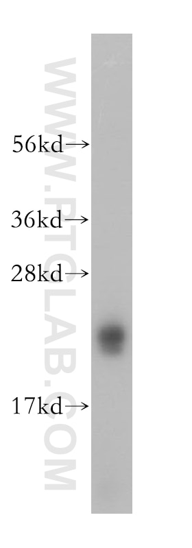 Western Blot (WB) analysis of human brain tissue using RTN1 (Isoform RTN1-C) Polyclonal antibody (15048-1-AP)