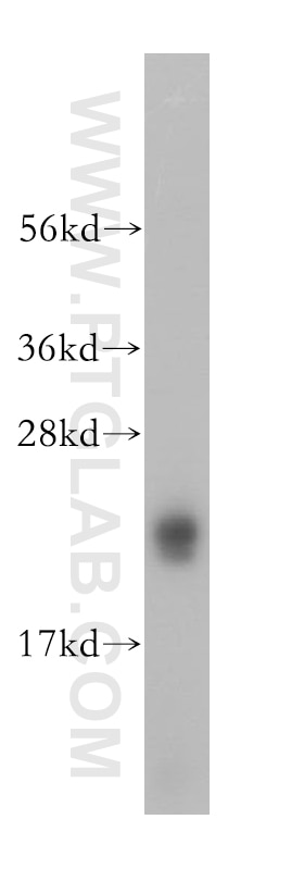 WB analysis of human brain using 15048-1-AP