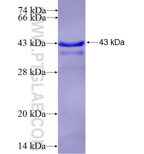 RTN1 fusion protein Ag7031 SDS-PAGE