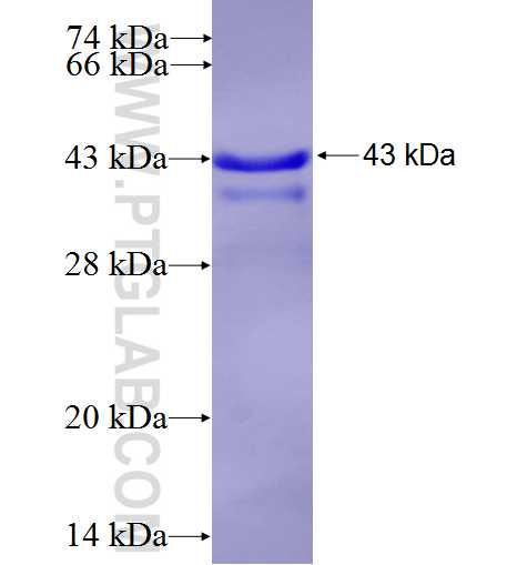 RTN1 fusion protein Ag7031 SDS-PAGE